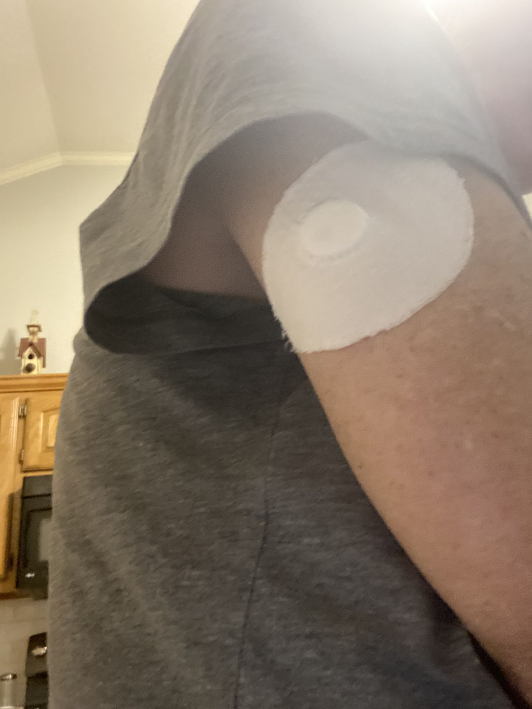Customer photo review of Skin Grip Original - Freestyle Libre Adhesive Patches