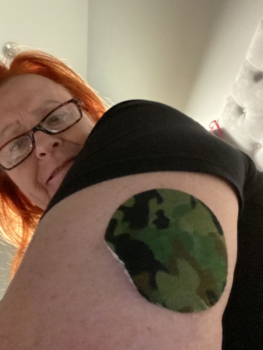Customer photo review of Skin Grip Original - Freestyle Libre Adhesive Patches