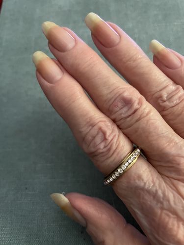 Customer photo review of Rocket Nail Fuel Nail Repair - Clear