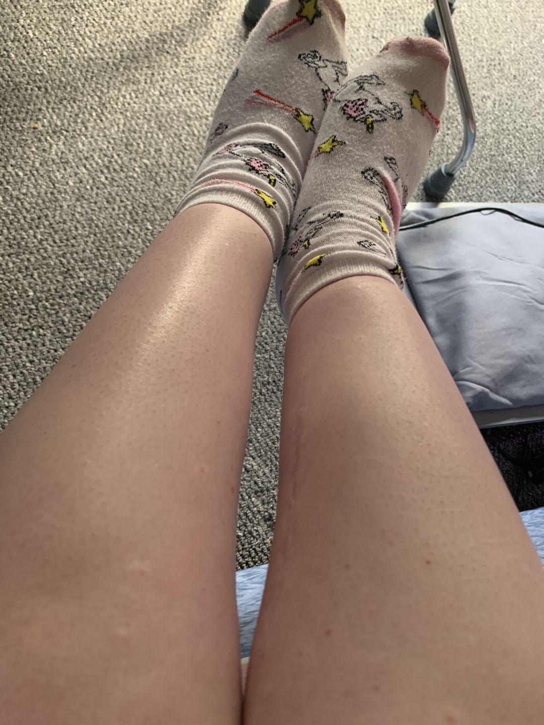 Customer photo review of Trimpod 3.0: The Ultimate Shaver for Women