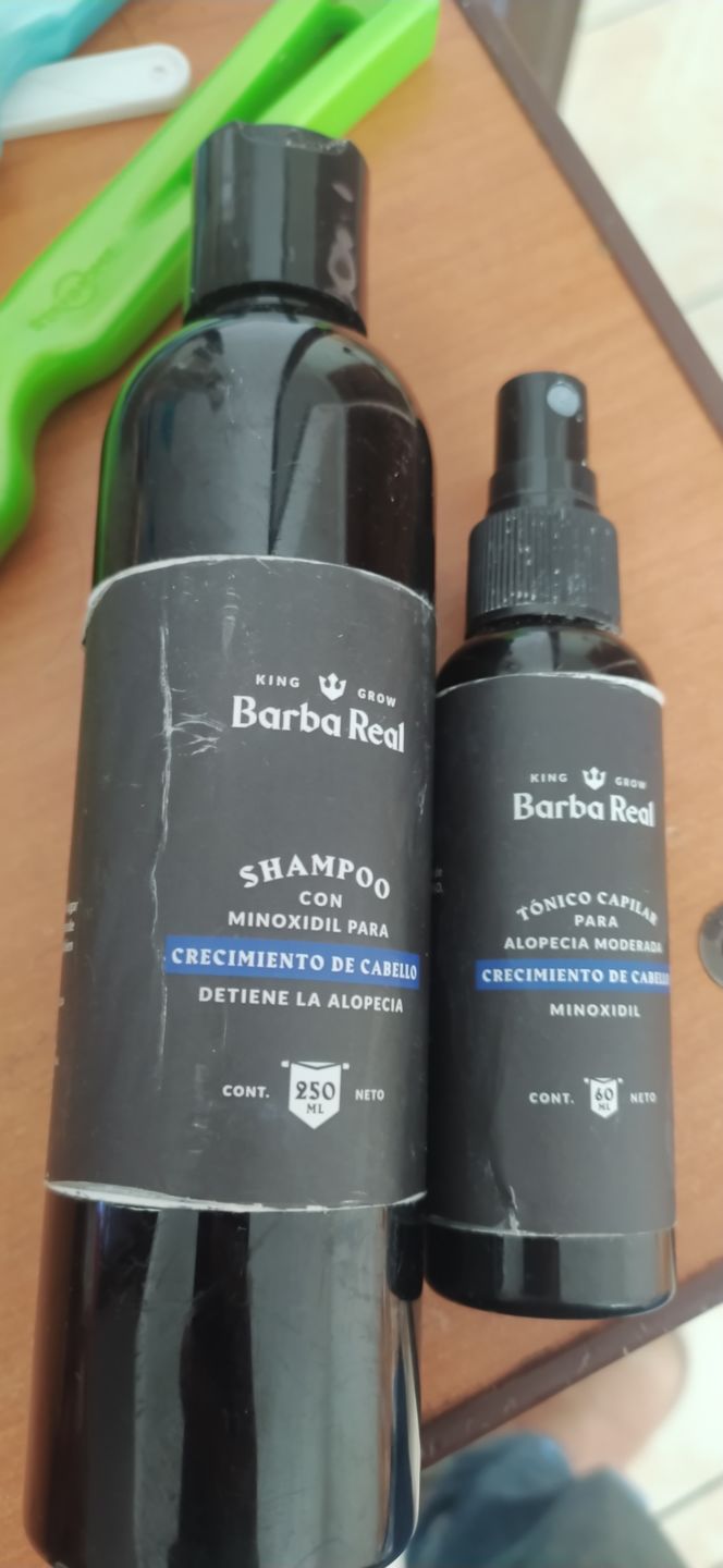 Customer photo review of Kit Adiós Alopecia