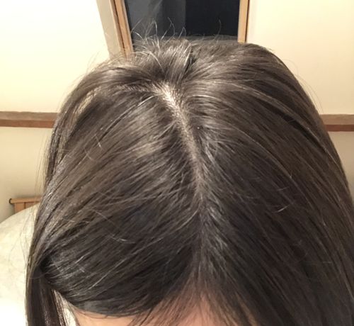 Customer photo review of Good Hair Vitamins Boost - 3 mois