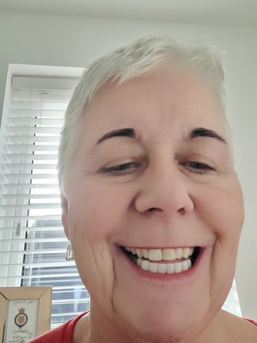 Customer photo review of Teeth-Veneer 2.0