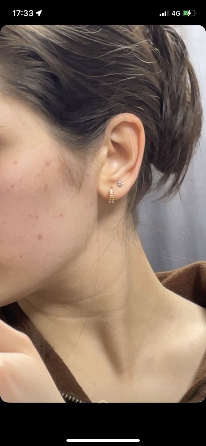 Customer photo review of Crystal Ball Piercing | Chirurgenstahl