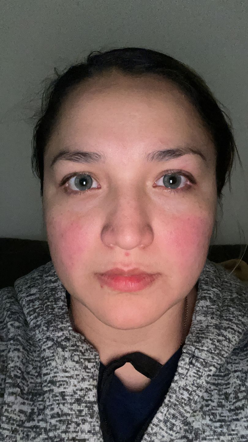 Customer photo review of Premium Candy Gray Prescription Colored Contact Lenses