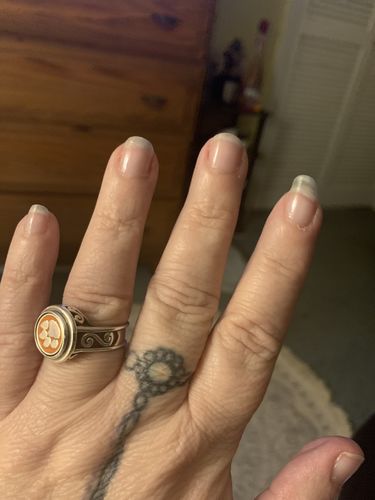 Customer photo review of Rocket Nail Fuel Nail Repair - Clear