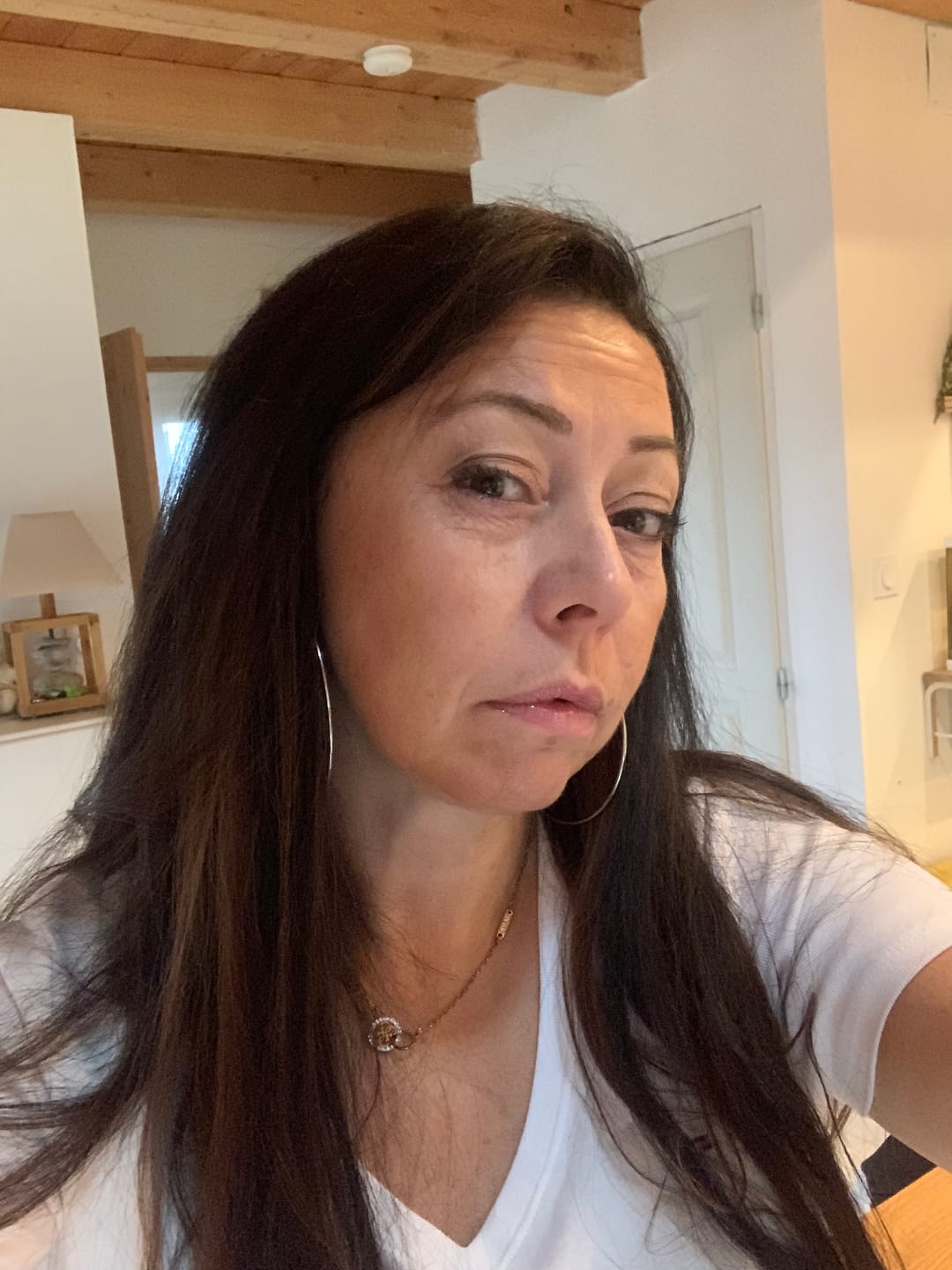Customer photo review of Acide Hyaluronique - 1 mois