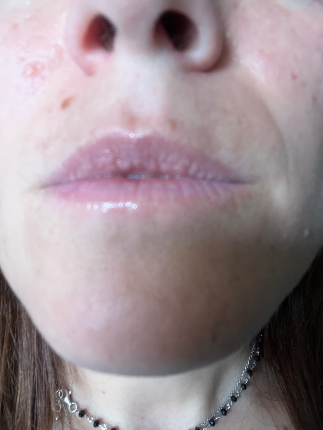 Customer photo review of LIP OIL CUTE LIPPY