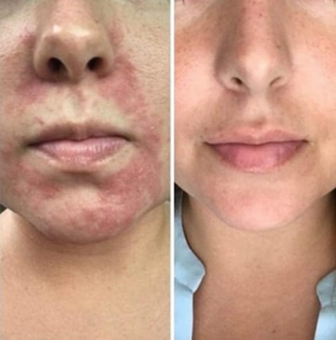 Customer photo review of Bliss™ Collageen Proteine