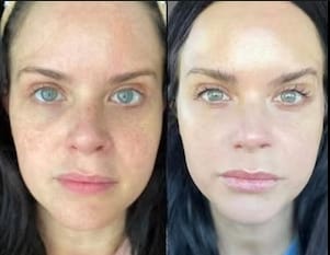Customer photo review of Bliss™ Collageen Proteine