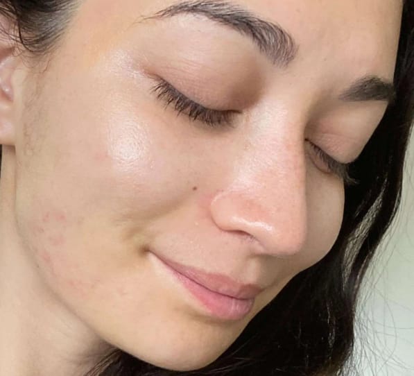 Customer photo review of Bliss™ Collageen Proteine