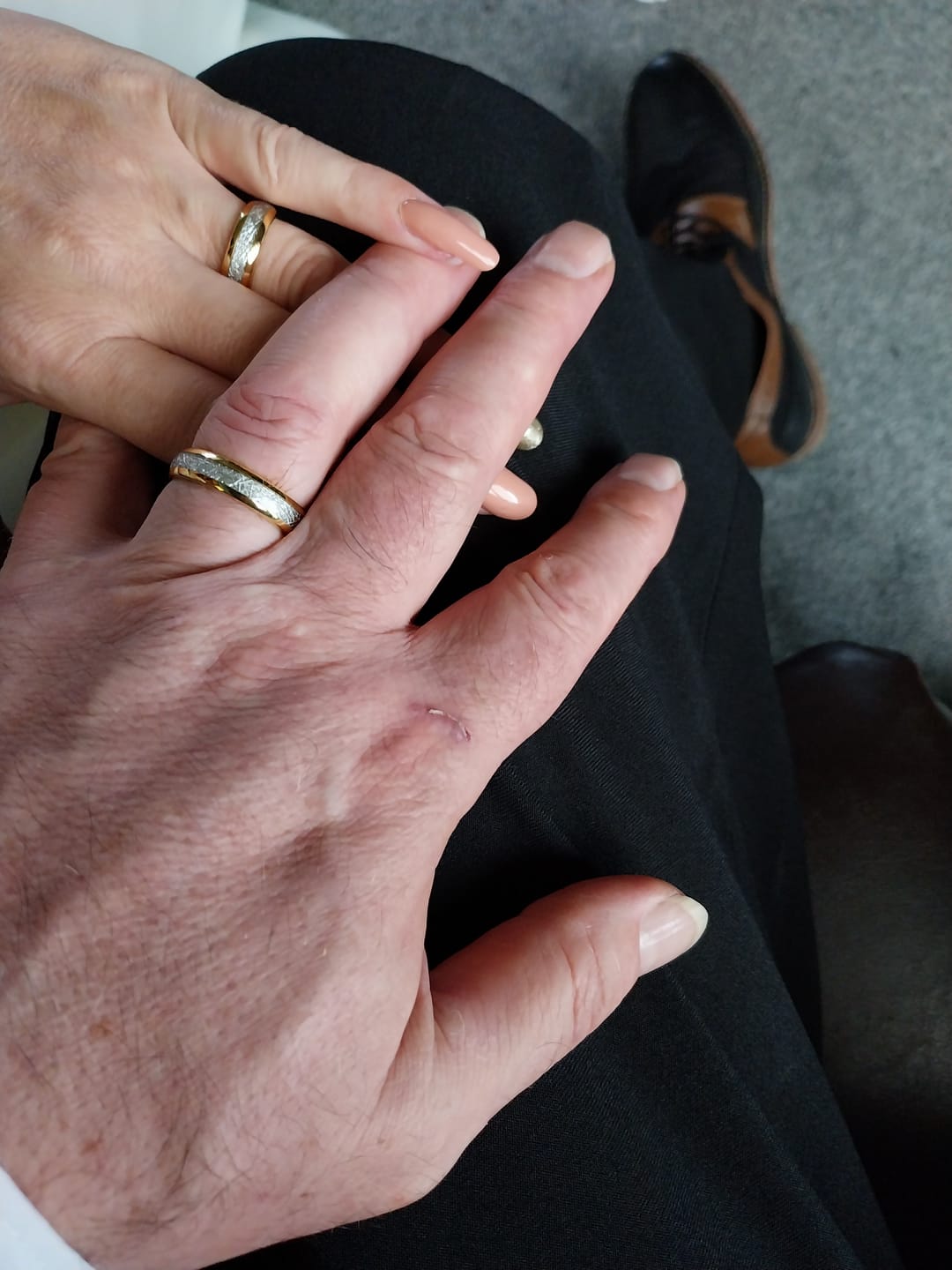 Customer photo review of The Golden Steel 6mm Wonder Ring