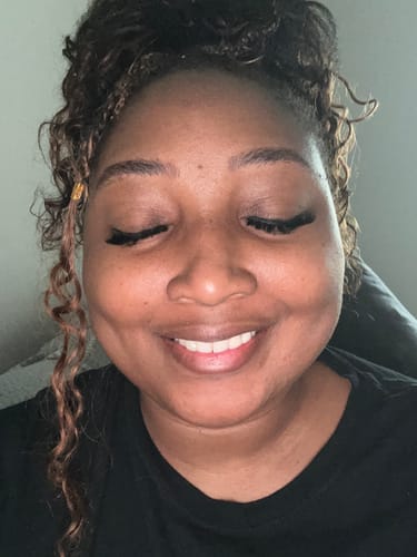 Customer photo review of Sun kiss bundle - Brightens + Even Skin tone + Reduce Acne