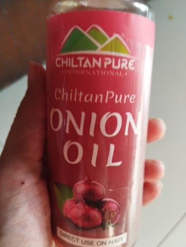 Customer photo review of Red Onion Oil 🧅 Reduces Hair Fall & Accelerates Hair Regrowth [پیاز کا تیل].. Trending.... 🔥