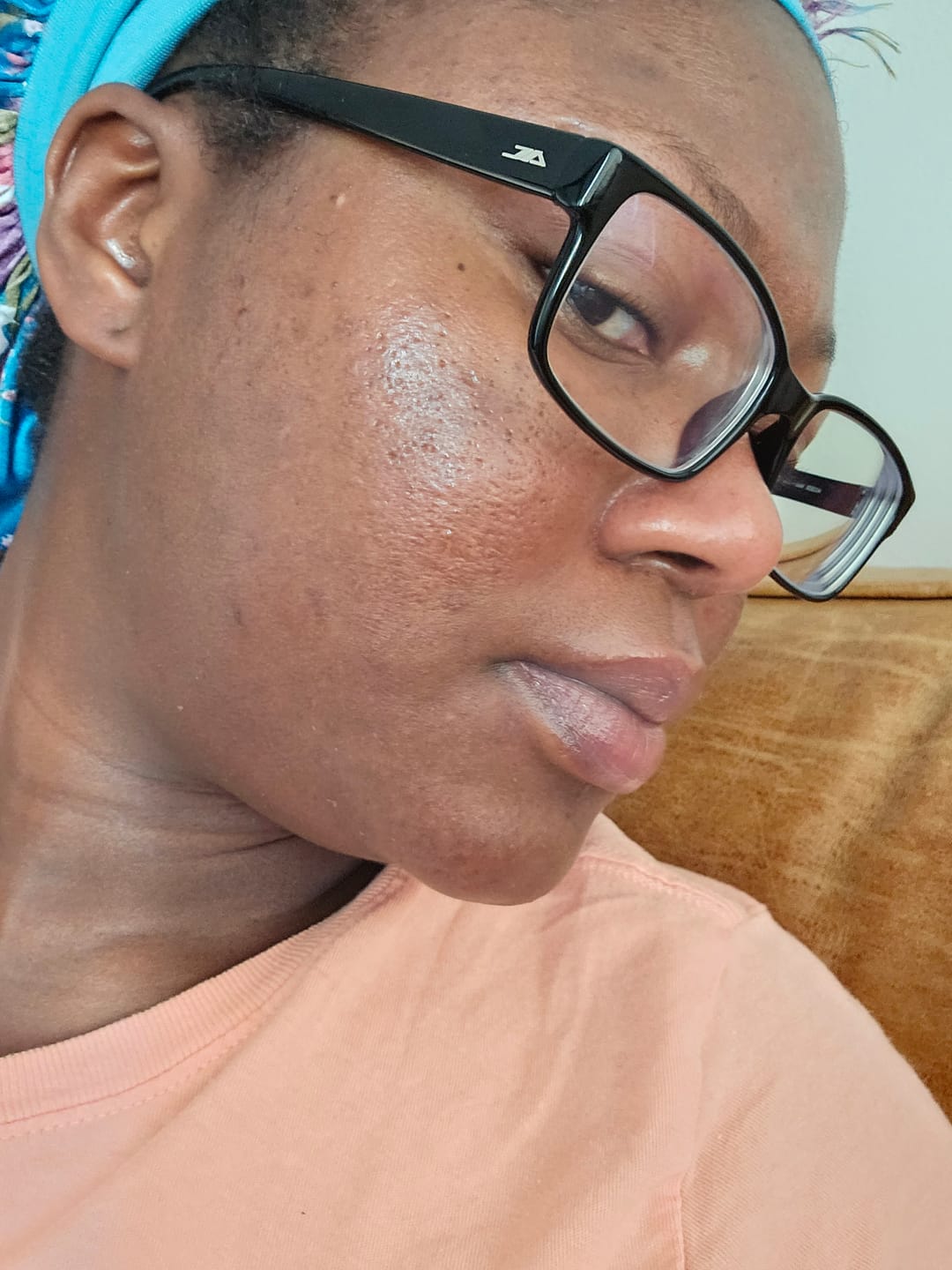 Customer photo review of HYDRATING MOISTURIZER