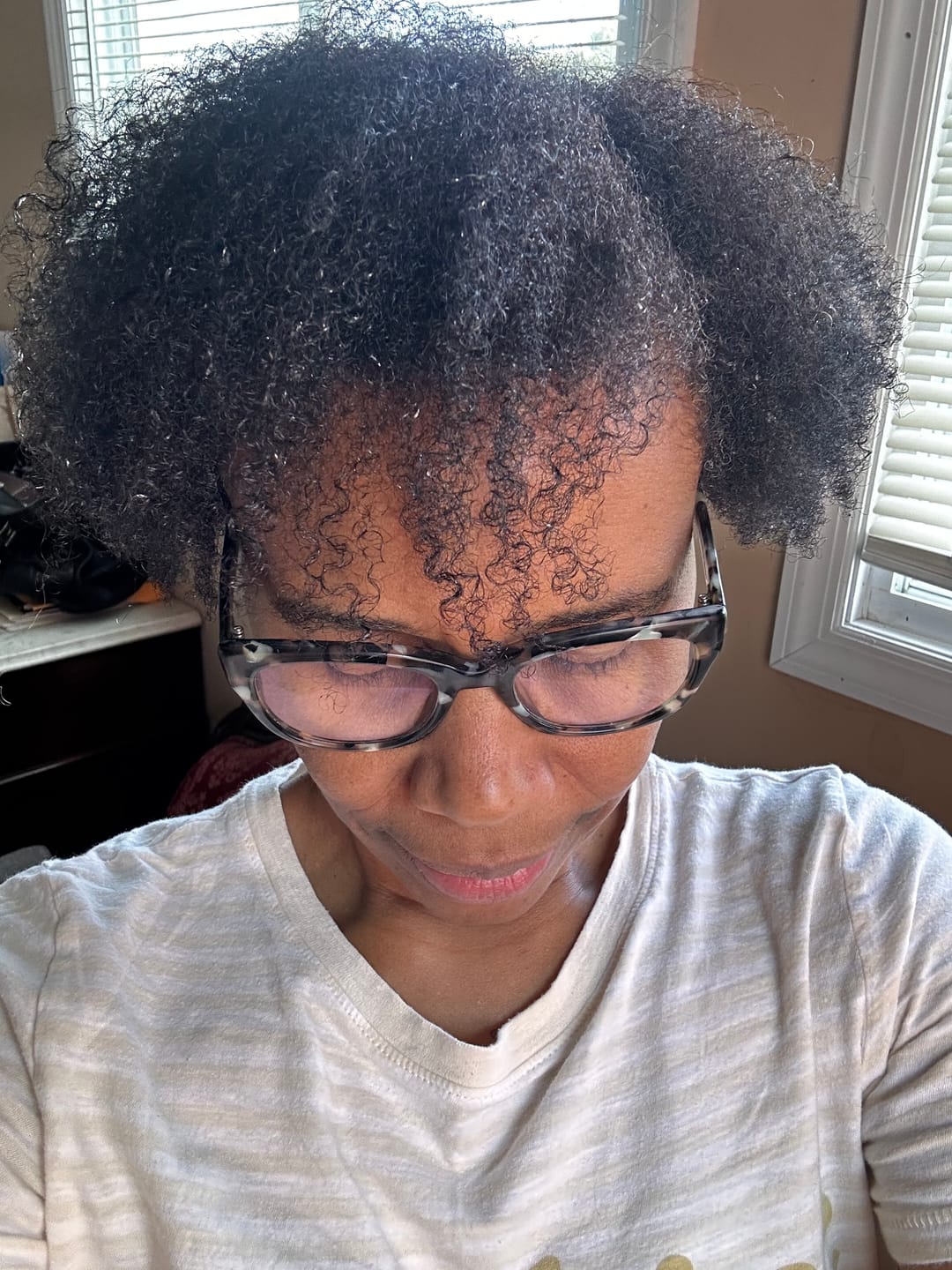 Customer photo review of Flake-Less Gel - Pineapple Potion