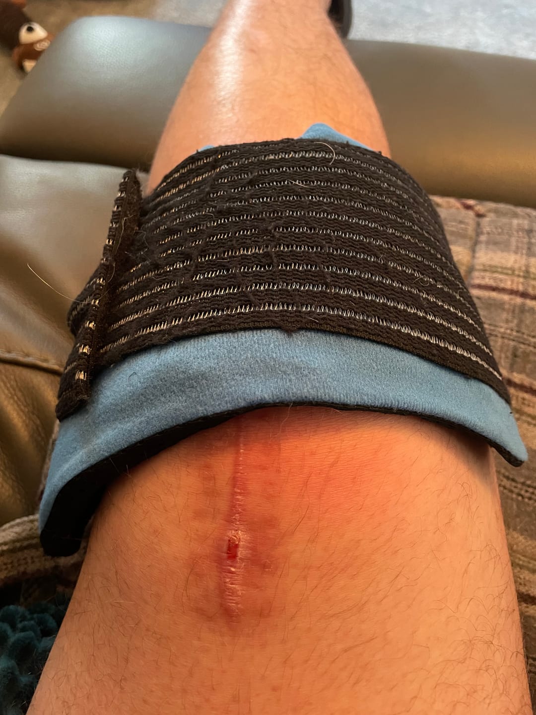 Customer photo review of GPD 3in1 - Knee Ice Pack Wrap for Injuries (Hot/Cold) Reusable
