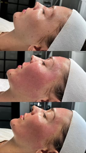 Customer photo review of The CryoPeptide 20 Pack