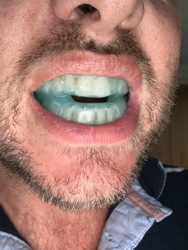 Customer photo review of SleepPro Custom AM