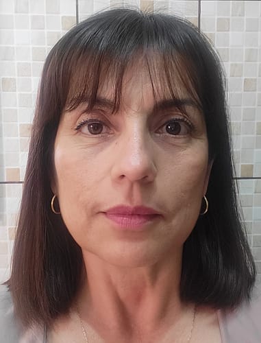 Customer photo review of Pack 5 productos: Hidro-K Día, Hidro-K Noche, Realiv, Limpiador Facial, Antiox+