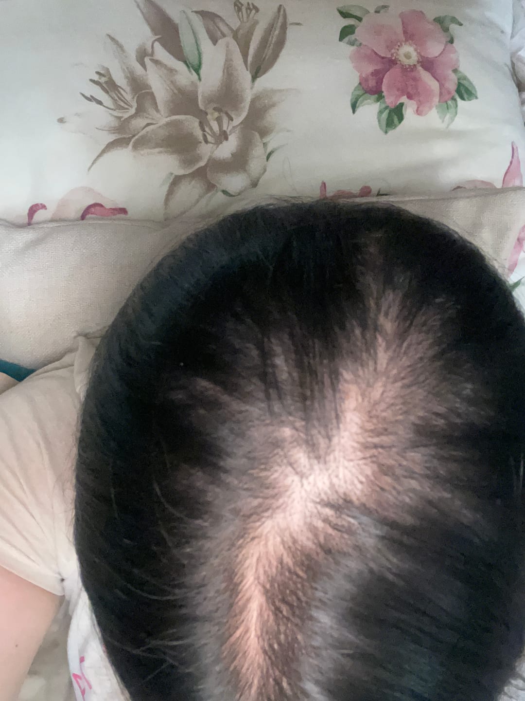 Customer photo review of HAIRtamin Fórmula Avanzada