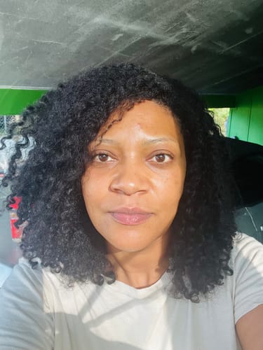 Customer photo review of BERRI-CLEAR+ 5 BERRY SUPERFRUIT SERUM