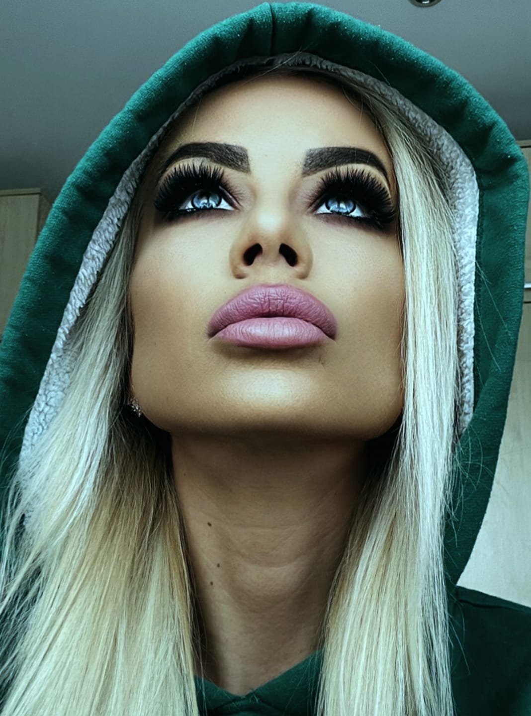 Customer photo review of Dawn Blue Colored Contact Lenses