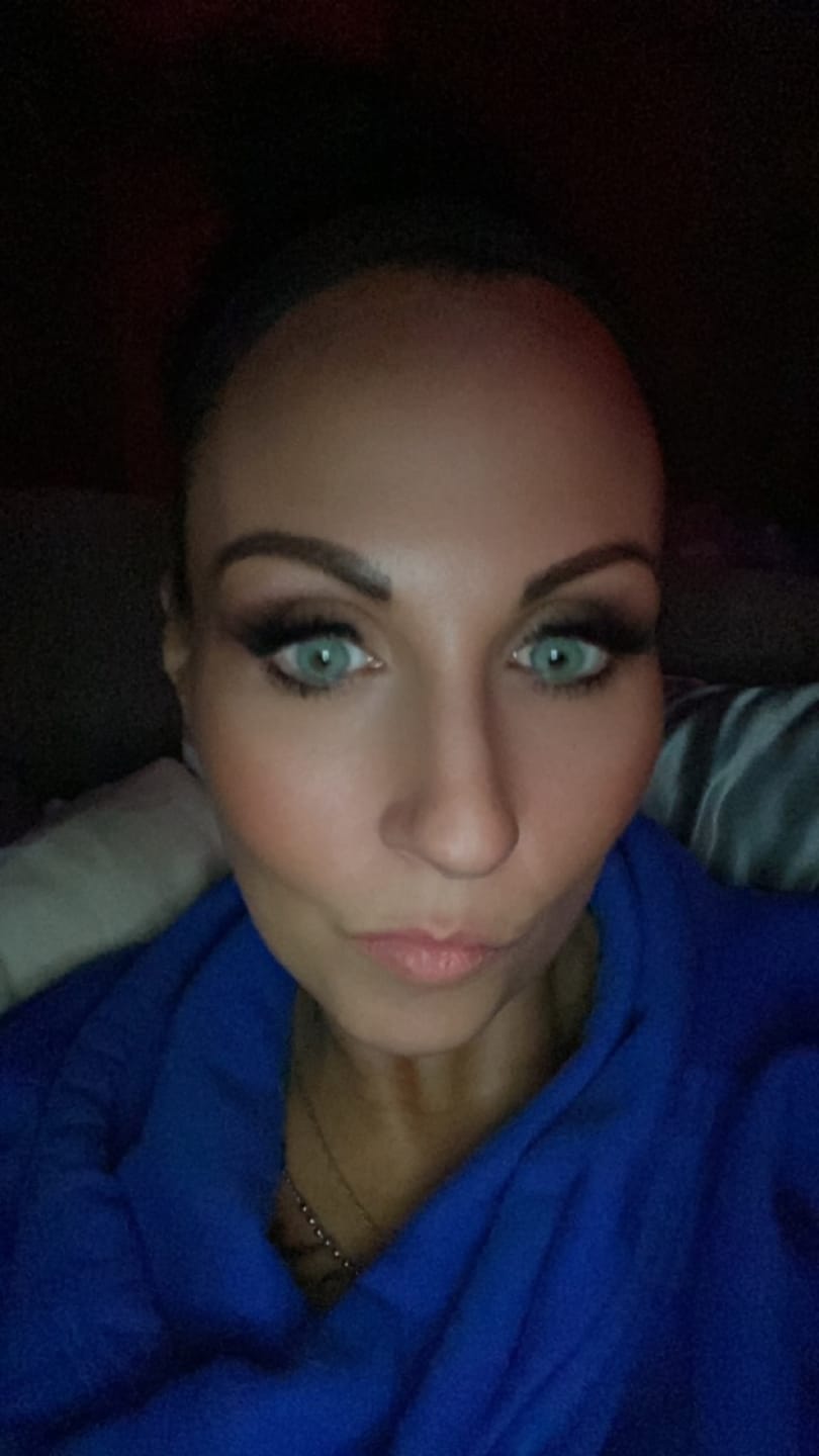 Customer photo review of Polar Light Blue Prescription Colored Contact Lenses