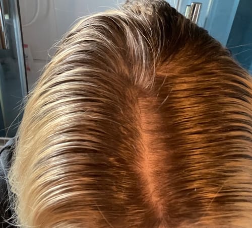 Customer photo review of Sunkissed Starter Kit