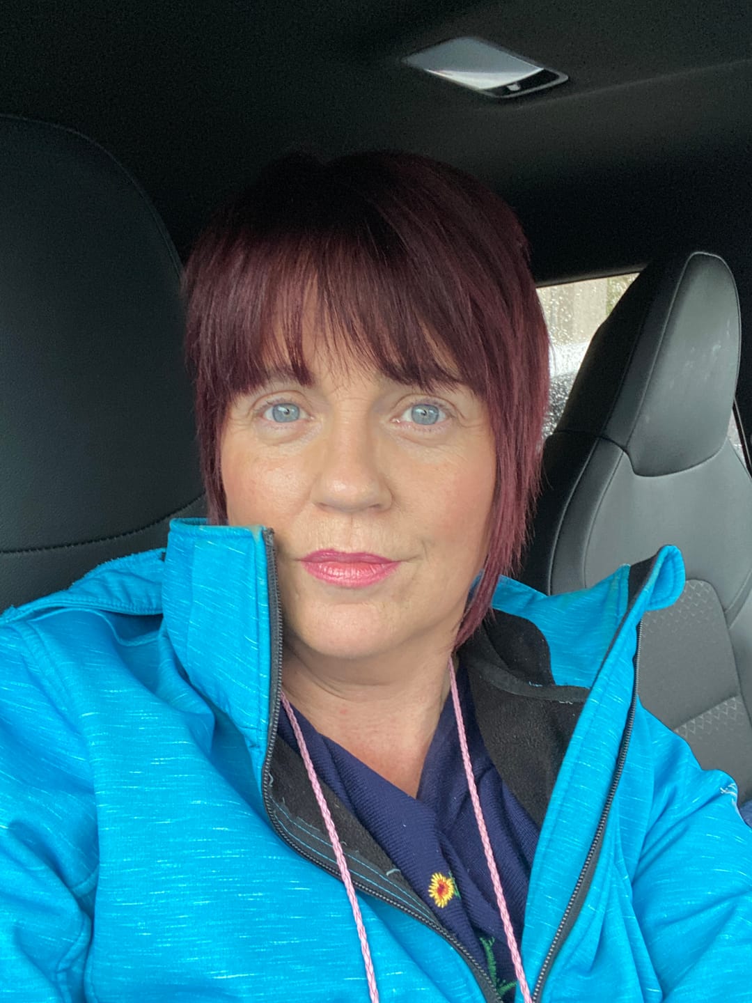 Customer photo review of Rosalique 3 in 1 Anti-Redness Miracle Formula SPF50