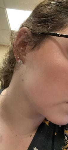 Customer photo review of Tri-Color Concealer Palette