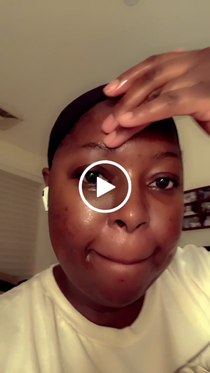 Customer video review of Turmeric Glow wash for black spots,acne & glow