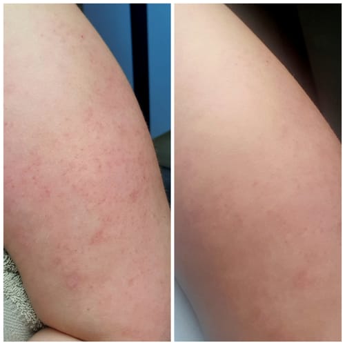 Customer photo review of Feuchtigkeitscreme