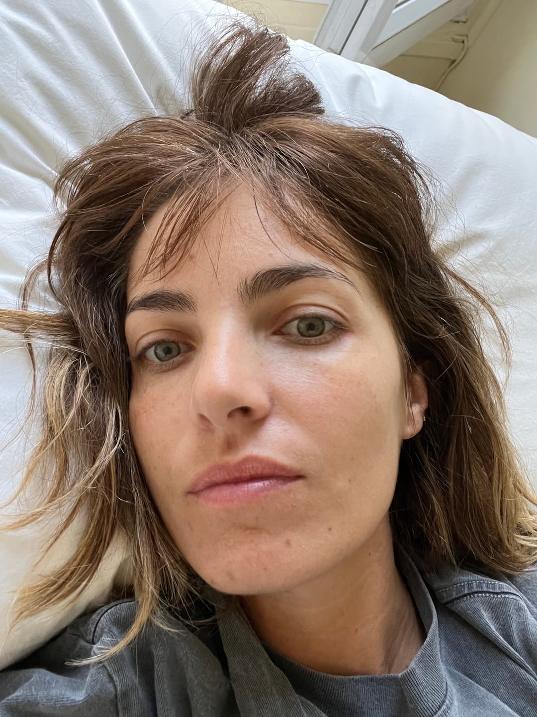 Customer photo review of Good Skin - 1 mois
