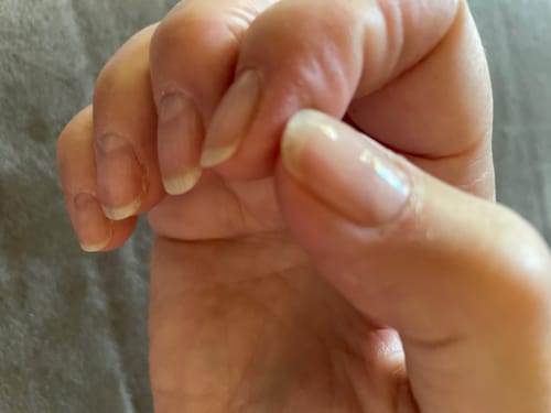 Customer photo review of The Nail Starter Kit