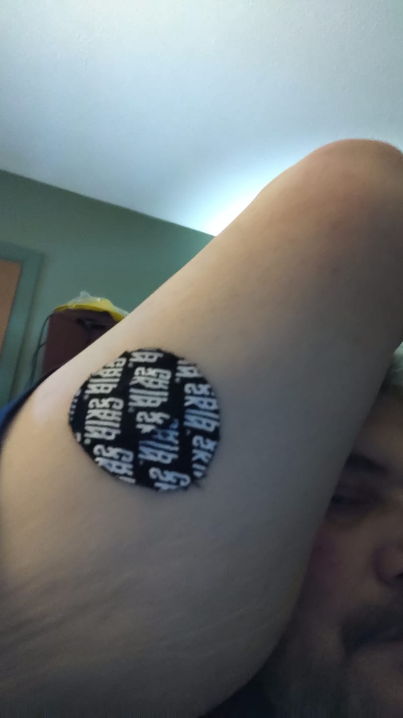 Customer photo review of Skin Grip Original - Freestyle Libre 3 Adhesive Patches