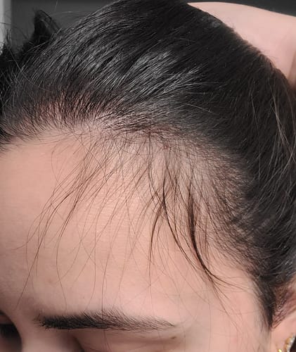 Customer photo review of Growth & Shine Shampoo