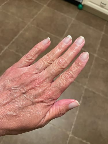 Customer photo review of Rocket Nail Fuel Nail Repair - Clear