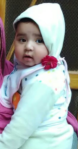 Customer photo review of Skin Rejuvenate - Best Skincare and Skin Glow Supplements