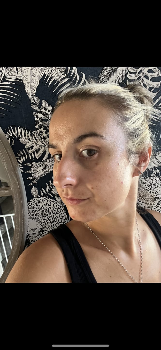 Customer photo review of Daily Collagen Powder