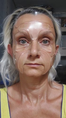 Customer photo review of Patchs Visage Anti-Rides Fontanay™ Réutilisables