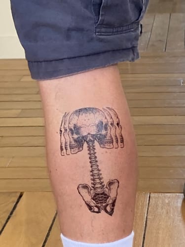 Customer photo review of Distorsion Crânienne