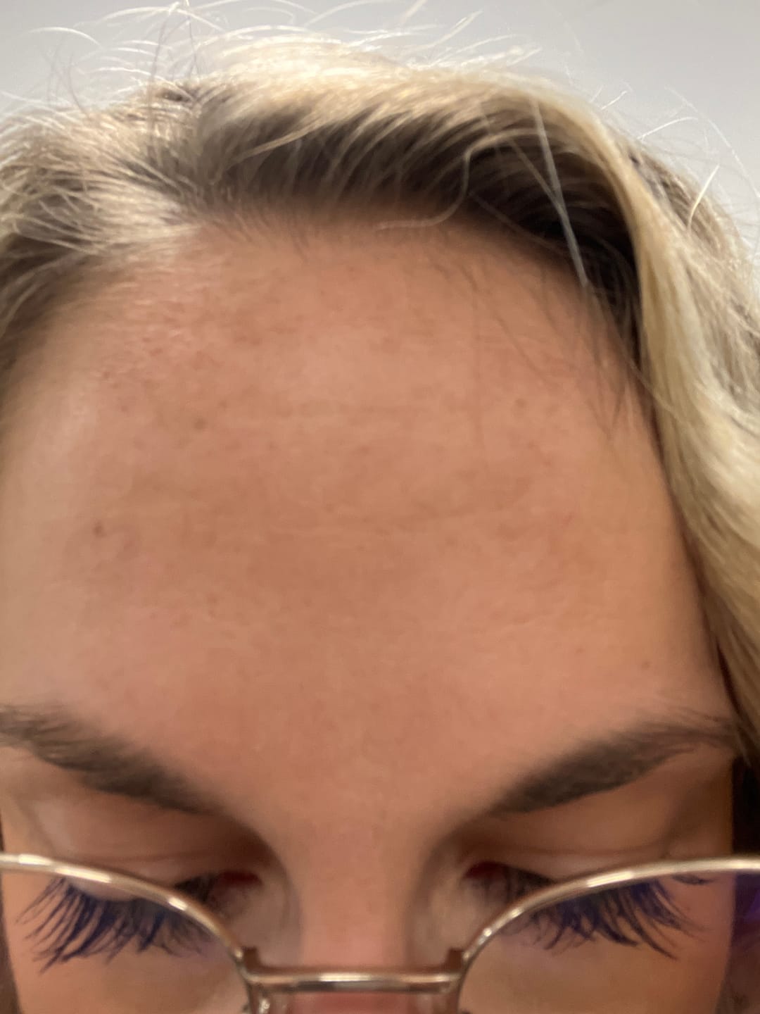 Customer photo review of Good Skin - 1 mois