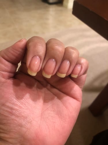Customer photo review of Rocket Nail Fuel Nail Repair - Clear