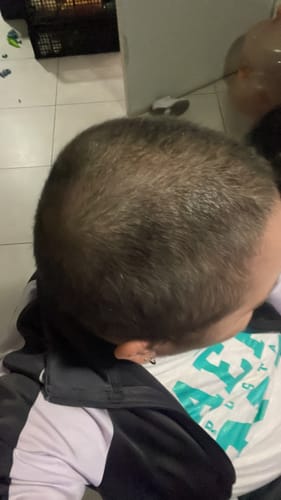 Customer photo review of HAIRtamin Fórmula Avanzada