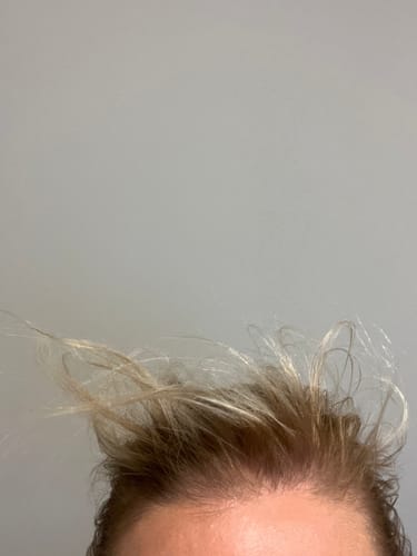 Customer photo review of Sunkissed Starter Kit