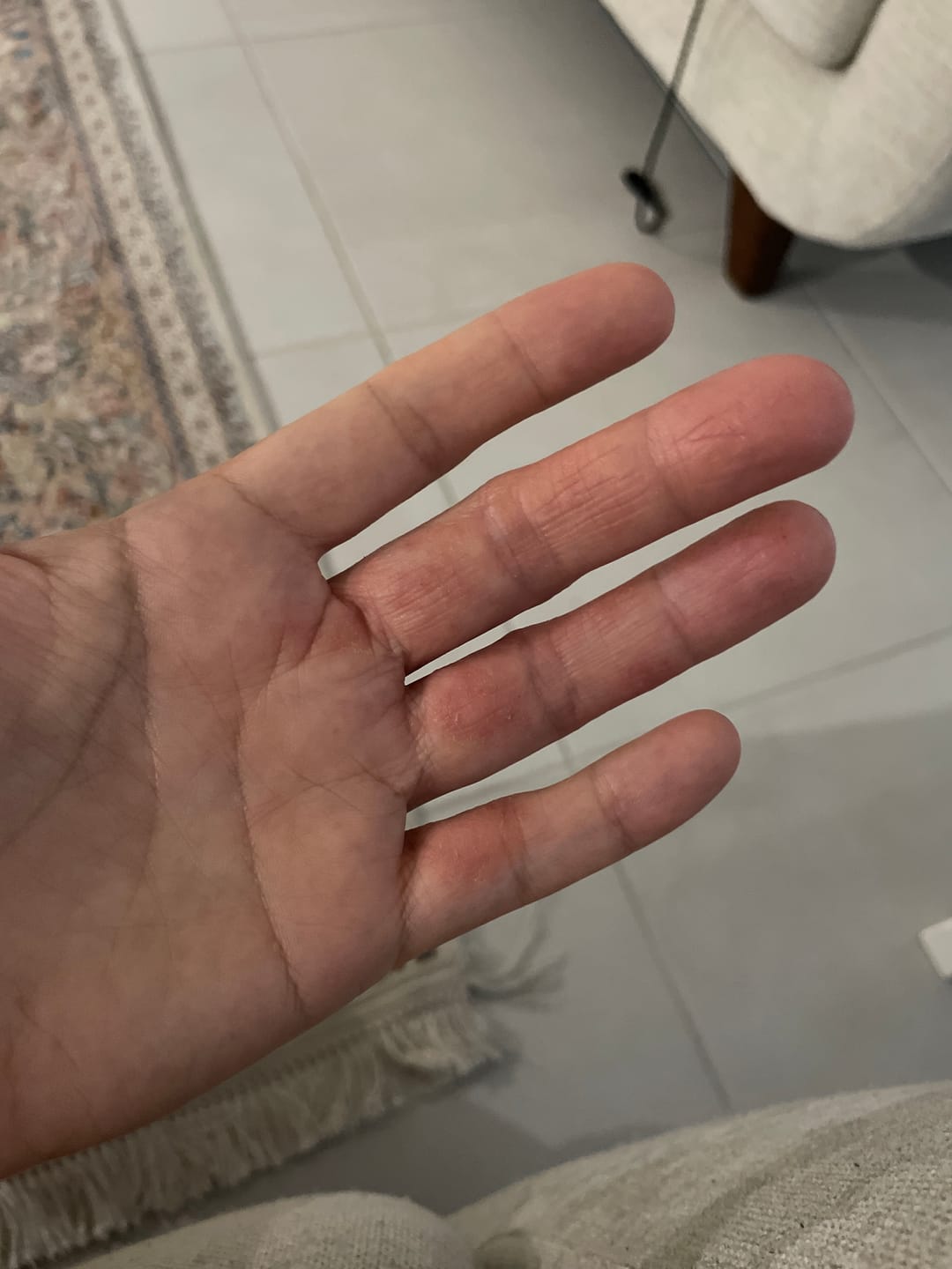 Customer photo review of Organic Barrier Balm