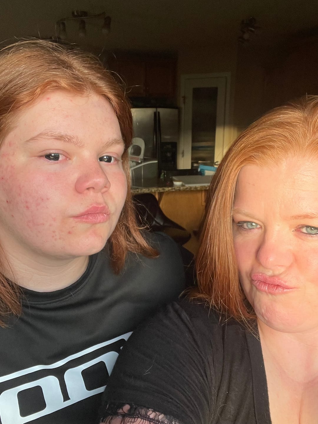 Customer photo review of PRIMAL ® Black Mini Sclera - Colored Contact Lenses