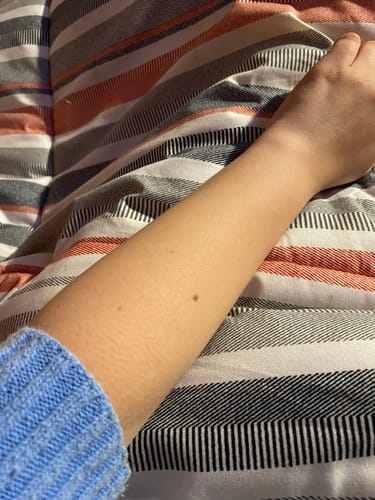 Customer photo review of Depilador Nuva Skin®