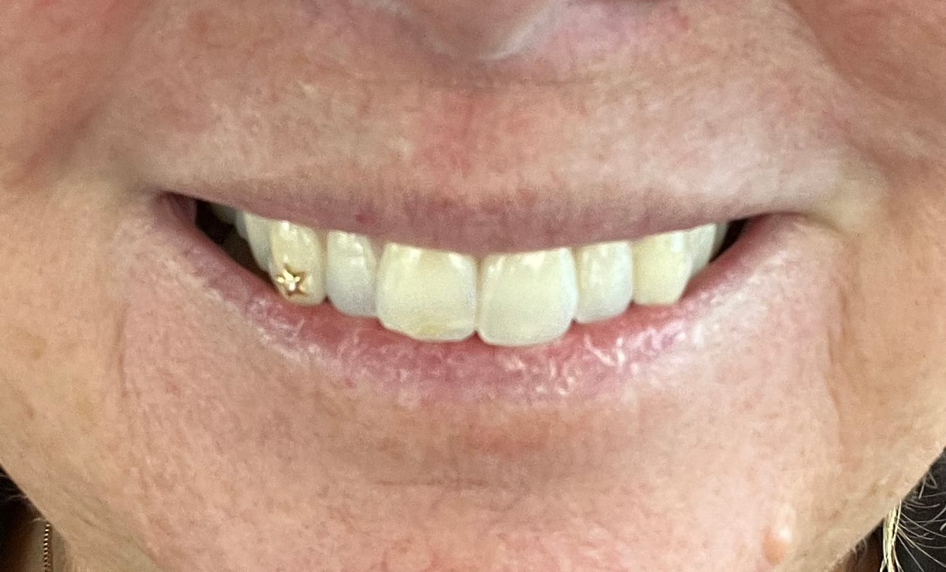 Customer photo review of Star w. Diamond 22-karat gold